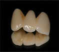 crown_lava_plus_zirconia